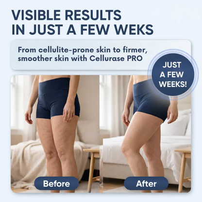 Cellurase Pro